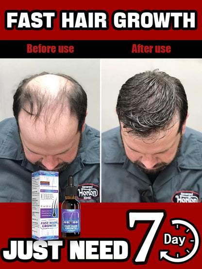 RevitaHair Pro