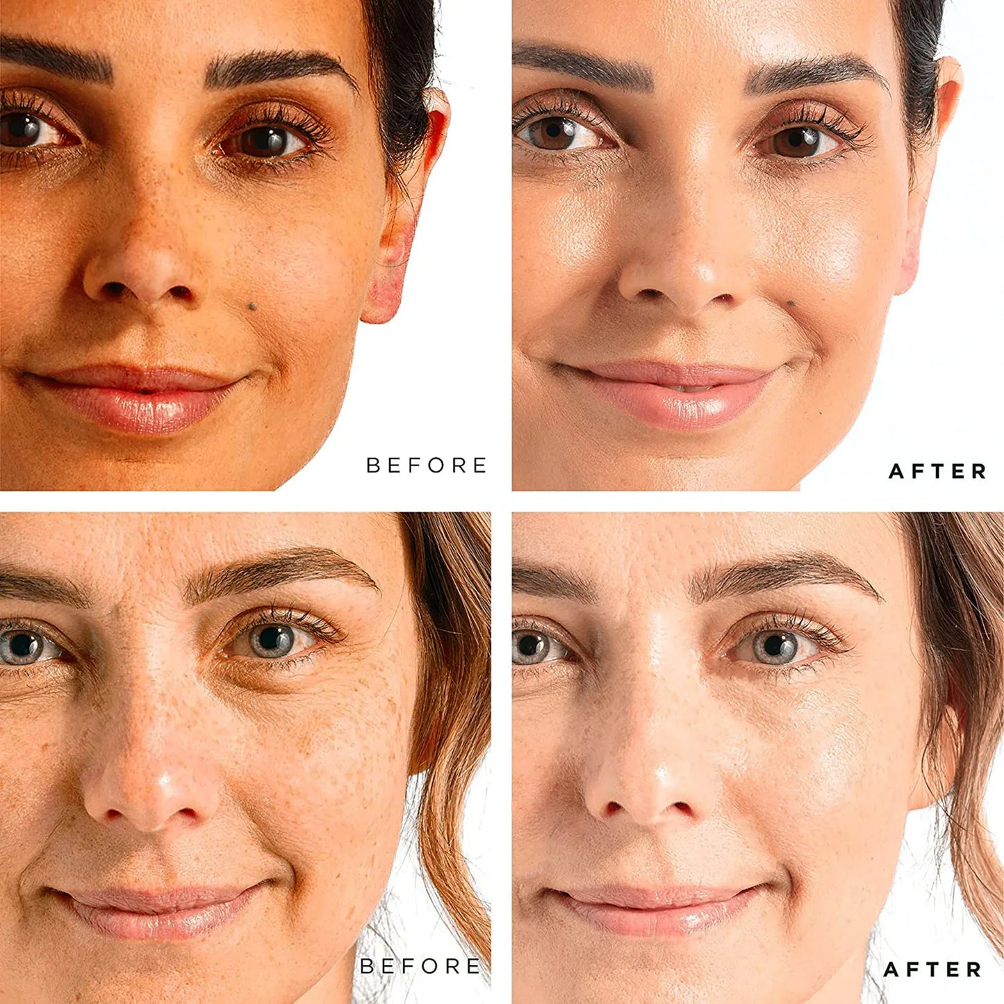 Soro de antienvelecimento facial